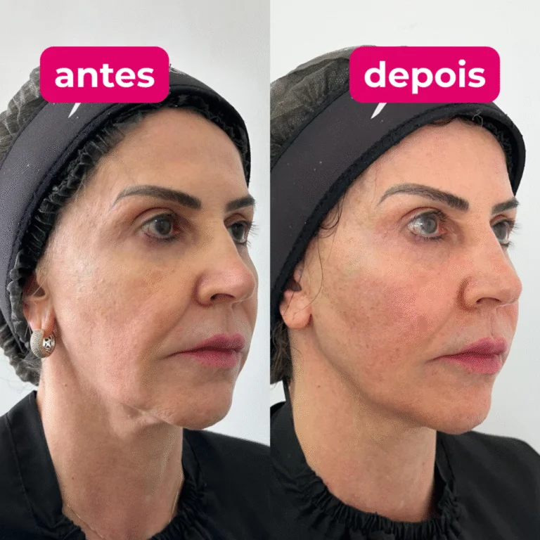 1-1024x1024-1-768x768