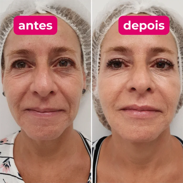 2-1024x1024-1-768x768