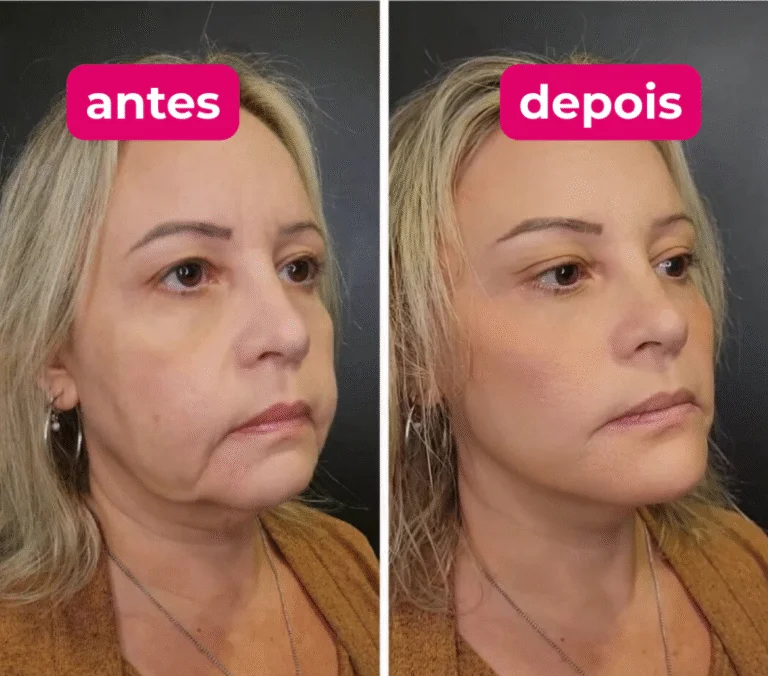 Untitled-design-1024x901-1-768x676